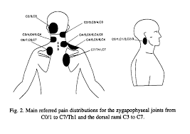 In, into, or towards a previous place or condition, or an earlier time: The Cloward Sign Cervical Referral Patterns Rayner Smale