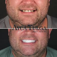 Assoc Prof Dr Ayça Tulga, DDS, PhD (@draycatulga) · Instagram 照片和视频