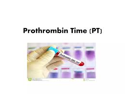 Image result for Prothrombin Time