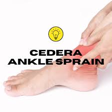 Maybe you would like to learn more about one of these? Bagaimana Cara Mengatasi Cedera Ankle Sprain Medifit