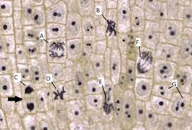 Onion root tip mitosis metaphase. 10 3 1 Interphase Mitosis And Cytokinesis Biology Libretexts