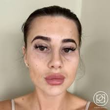 Precision Aesthetics added a new photo.