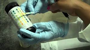 Neon Manual Multistix Urinalysis Procedure Mov