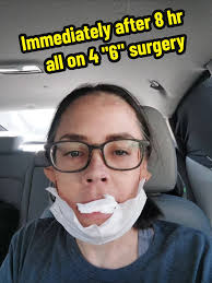 Ashley Layne No Teeth