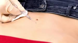 A 14 gauge sterile piercing needle, a 14 gauge belly button ring made from stainless steel, titanium or bioplast, some rubbing alcohol or alcohol wipes, a body ink marker, a piercing clamp and some cotton balls. 95 Navel Piercing Stock Videos Royalty Free Navel Piercing Footage Depositphotos