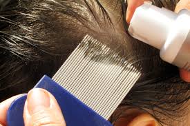 Mechanical removal involves applying conditioner to dry hair. Head Lice Healthdirect