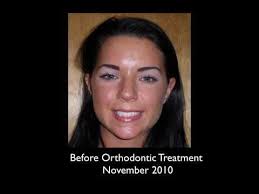 Dental Associates of Connecticut