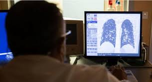 Typically, this symptom begins to occur when the cancer cells grow. Innovative Pneumonia Tech Can Diagnose In 7 Minutes