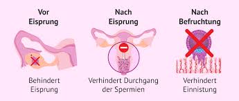 Wann findet die einnistung statt? Wirkungweise Der Pille Danach