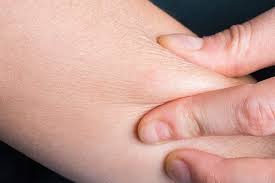 Image result for Dry Skin