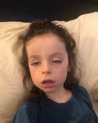 Post 2 of 2* It took Tristan a couple days in the hospital to wake up  enough to start drinking so he could come off the IV fluids. He'd been  through a