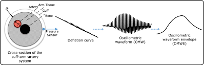The automatic blood pressure cuffs inflate by themselves once the monitor is switched on. Oscillometry System Physical Setup The Intraarterial Bp And The Cuff Download Scientific Diagram