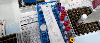 Une information et des outils pour faciliter leur pratique un dépliant « guide pratique », explique dans les grandes lignes les recommandations vaccinales chez le patient immunodéprimé ou malade chronique et chez son entourage. Covid 19 La Has Valide Le Traitement Preventif Pour Les Immunodeprimes Le Point