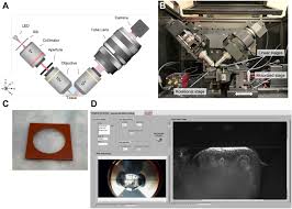 Scattering-Based Light-Sheet Microscopy Imaging of Human  Papillomavirus–Associated Squamous Lesions of the Anal Canal: A  Proof-of-Principle Study