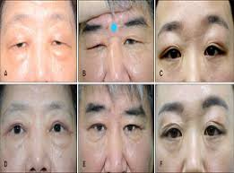 D'après le ministre de l'intérieur, une. Ad Annals Of Dermatology