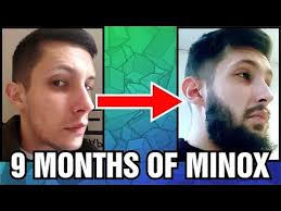 Home beard care beard care tips stimulate beard growth with minoxidil: Minoxidil Beard 9 Months Week 39 Minoxidil 5 For Beard Growth Facialfuzzfridays Youtube