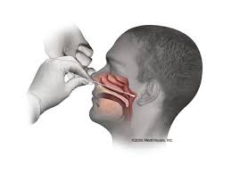 Their locations and structures are best viewed when the head is shown in sagittal section. Coronavirus Unpleasant Nasal Swab Test Image Goes Viral New York Daily News