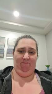 leaving orc and Dr pastens clinic just had gastric sleeve  yesterday#drpasten #tijuana #wls