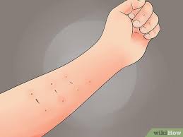 A red rash is among the most common symptoms. 3 Ways To Tell If A Tattoo Is Infected Wikihow