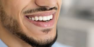 Image result for Teeth Whitening