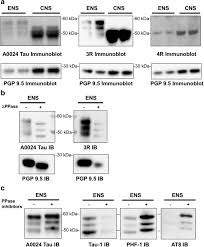 Also known as chrismon) is one of the earliest forms of christogram, formed by superimposing the first two (capital) letters—chi and rho (χρ)—of the greek word χριστοσ in such a way that the vertical stroke of the rho intersects the center of the chi. Characterisation Of Tau In The Human And Rodent Enteric Nervous System Under Physiological Conditions And In Tauopathy Acta Neuropathologica Communications Full Text