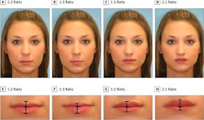 The Most Beautiful Female Lips Study Finds 1 2 Ratio Is Most Attractive For A Woman S Face Lip Shapes Lip Fillers Female Lips