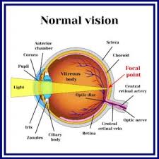 Image result for Refractive Error