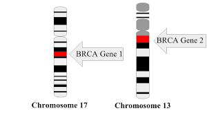 Her mother, julia, had a preventative both men and women carry the brca gene and children inherit one copy from each parent. Brca Mutation Wikipedia