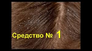 как избавится от перхоти в домашних условиях за 1 день Kak Bystro Izbavitsya Ot Perhoti Zud I Perhot 1 Protivperhoti Pe Perhot Maski Dlya Volos Shampun