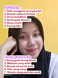 Atasi Jerawat Sebelum Lebaran: Tips Glow Up untuk Acne Fighter