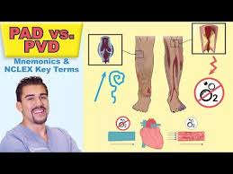 Peripheral Arterial Disease Top Tested Signs Symptoms For