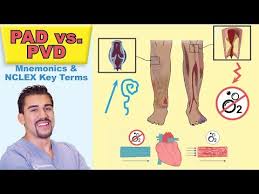 peripheral arterial disease top tested signs symptoms for