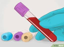 Die Gfr Rate Erhohen Mit Bildern Wikihow