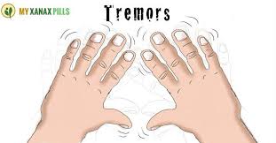 Convalesce Your Tremors With Symmetrel Tremor Treatment Essential Tremors Chronic Fatigue Symptoms