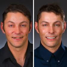 DREAM DENTAL IMPLANT CENTER