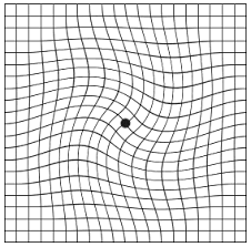 Amsler Grid Test Retina Ophthalmology Gettysburg Pa