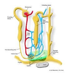 Image result for Calcium Nephrolithiasis