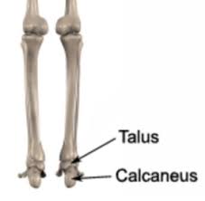Sinus Tarsi Syndrome Physioadvisor