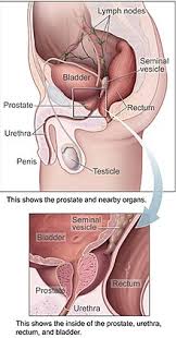 The average age of men at diagnosis is about 66. Prostate Cancer Wikipedia