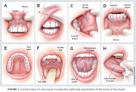 Cancer is theoretically the oldest disease known to man, it has been found in mummies on the mountains of peru. Azmoudeh Dental Oral Cancer Exams What You Should Know