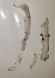 If your symptoms return or never completely left, you can assume that some eggs escaped or you still have a particularly resistant tapeworm stage. An Array Of Toilet Paper Like Worms Freak Out The Resident Of This Fresno Home All About Worms