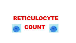 Image result for Reticulocyte Count