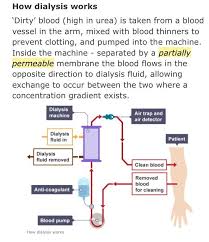 Www Goodhealthboss Com Healthy Soul Dialysis Nurse Dialysis Nursing Information