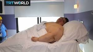 Franco hadde utpekt prins juan carlos til sin etterfølger, og den nye kongen åpnet for demokratiske reformer. World S Heaviest Man Juan Pedro Franco Discharged After Surgery Youtube