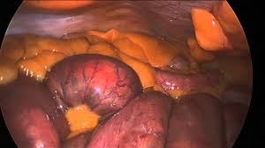 Within the abdomen itself, there are some organs that are considered to be major organs, and because of this, it needs to well protected and taken care of. Abdominal Anatomy Tour Youtube