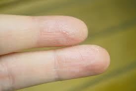 Once you've buffed away the glue, you can buff and apply nail polish the way you normally would. How To Get Nail Glue Off Of Your Skin Glue On Nails Nail Glue Remover Diy Nail Glue