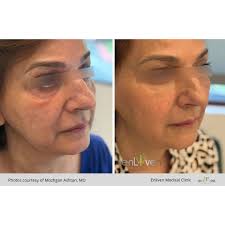 Enliven Medical Clinic (@dr.mozhganashtari) · Laguna Hills, CA