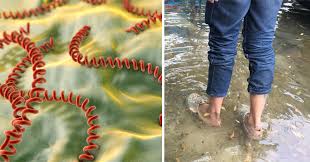 Hasil gambar untuk leptospirosis