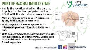 Image result for Point of Maximum Impulse