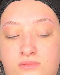 Karley Brown LE (@skinsationstl) • Instagram photos and videos